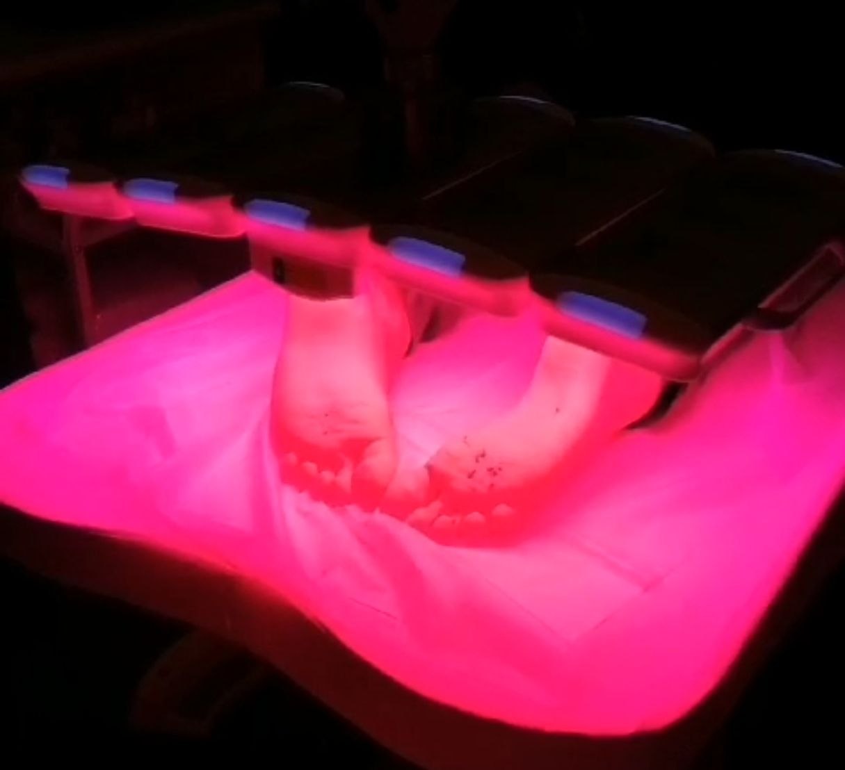 Использование ФДТ при лечении онихомикоза