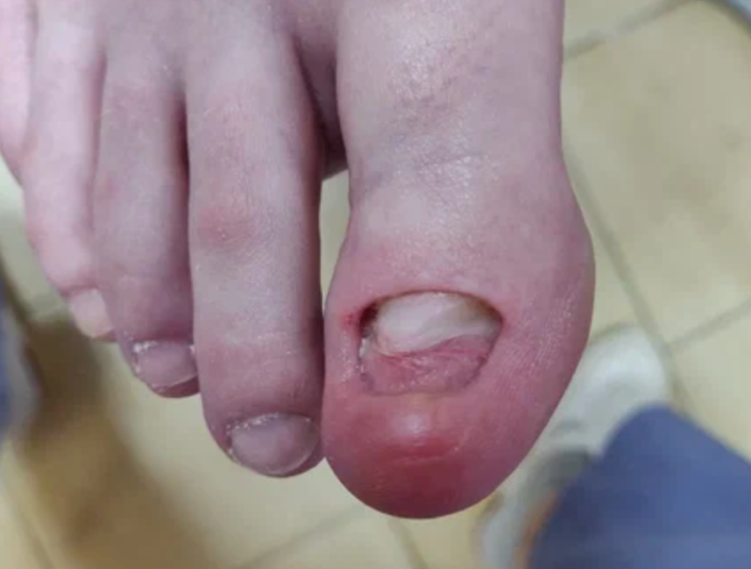 После лечения